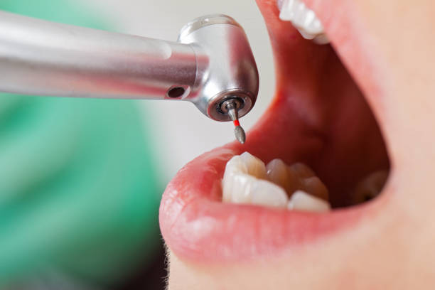 Best Pediatric Emergency Dentist in Piermont, NY